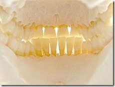 歯牙模型